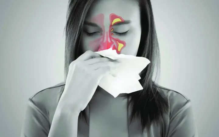 Sai lầm khi tự chữa viêm xoang theo “bác sĩ mạng”