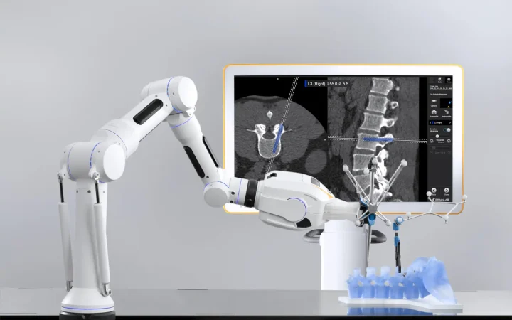 Ứng dụng Robot trong điều trị bệnh lý cột sống