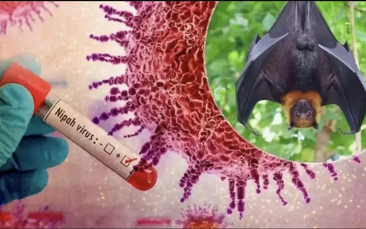 Bộ Y tế hướng dẫn chẩn đoán và điều trị bệnh do virus Nipah