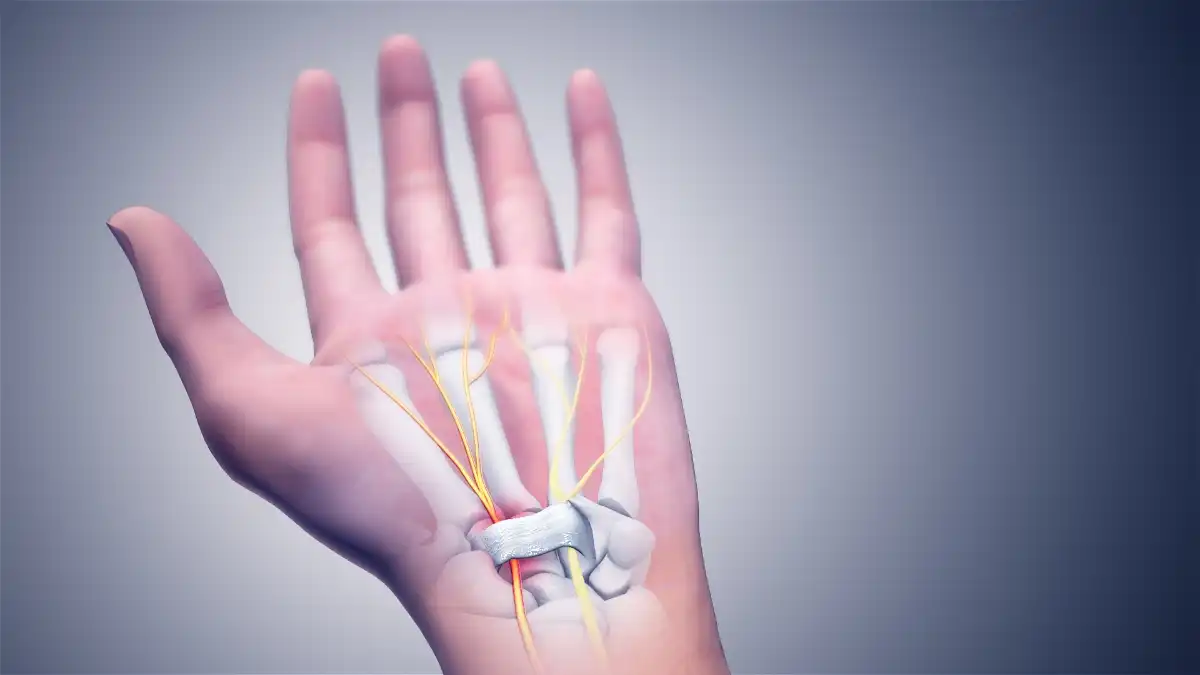 “Dân văn phòng” cần cảnh giác với hội chứng ống cổ tay