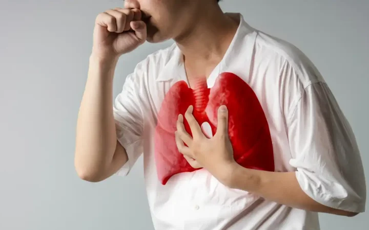 Cấp thiết đưa phát hiện lao vào khám sức khỏe định kỳ